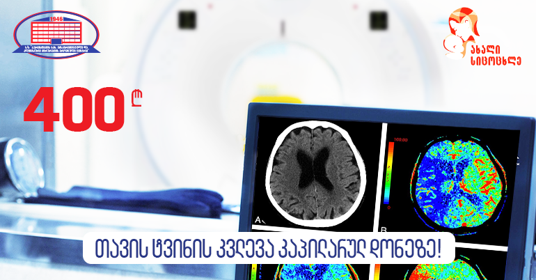 თავის ტვინში მიმდინარე პათოლოგიური პროცესების დიაგნოსტირება და მკურნალობა – გთავაზობთ თავის ტვინის კვლევას კაპილარულ დონეზე